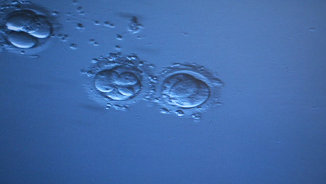 IVF an der Kinderwunschambulanz im Krankenhaus Oberpullendorf
