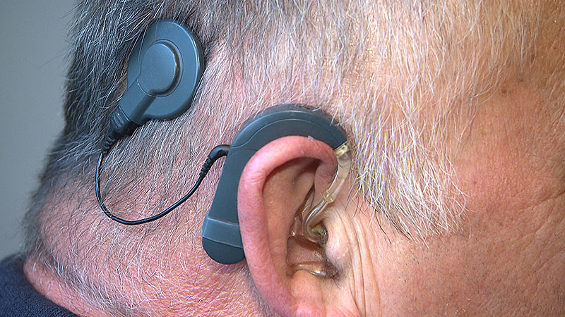 Tag des Hörens Hörimplantat